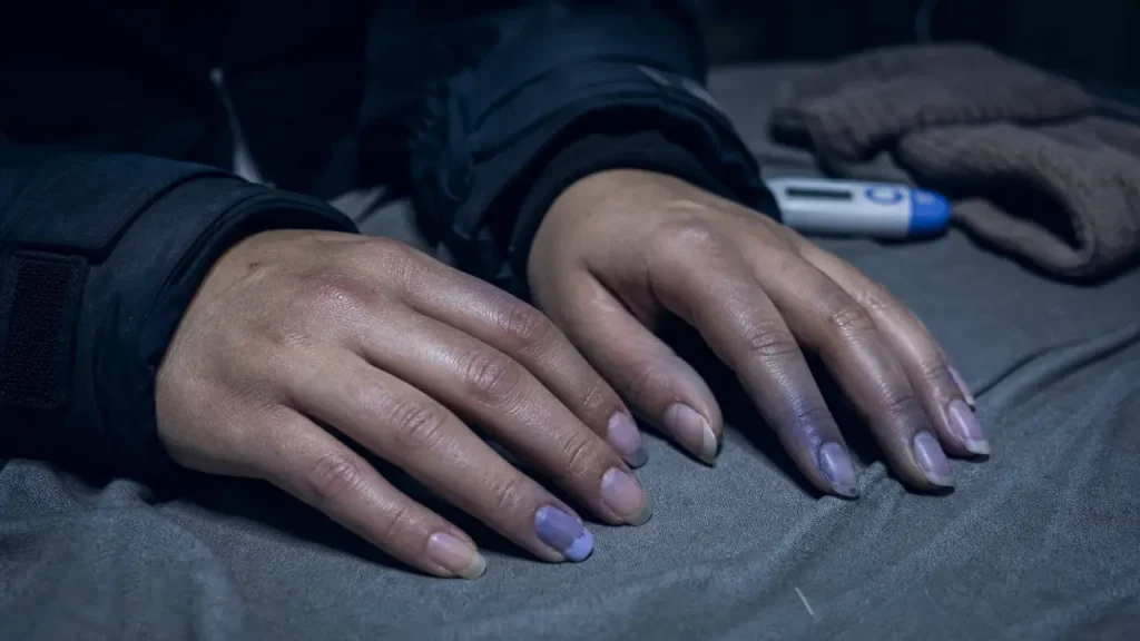 Ongles violet, signe de circulation sanguine
