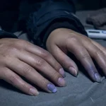 Ongles violet, signe de circulation sanguine