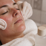 Rougeur visage : crème hydratante sur joues et nez